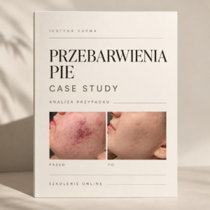PRZEBARWIENIA PIE - CASE STUDY